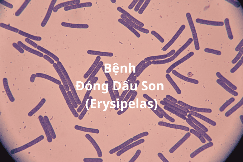 benh dong dau son erysipelas 1